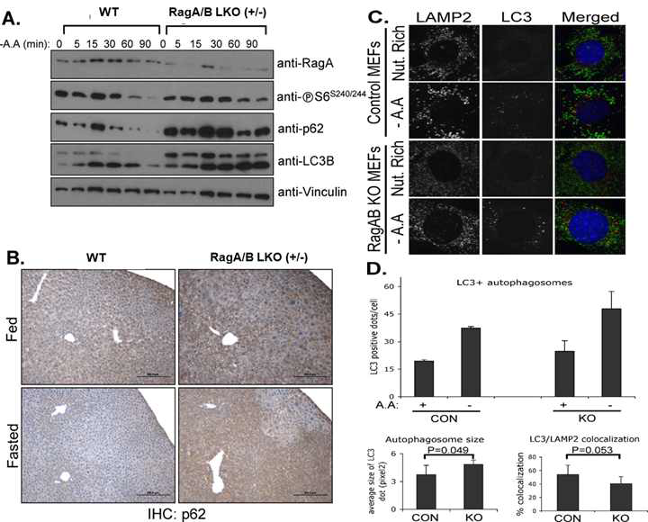 Autophagic flux is defective in RagAB LKO cells. (A) Protein levels of RagA, p62 and LC3B in primary hepatocyte cell in the presence or absence of amino acids for indicated time. (B) P62 immunohistochemical staining of liver tissue in fasted and fed conditions. (C) Immunofluorescent colocalization of LC3 and LAMP2 in the presence or absence of amino acids.(D) LC3 positive cells and autophagosome size were quantified.