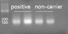 Electrophoretic analysis of genomic DNA from ear. DNA (8ul) was loaded on a 2% agarose gel and visualized by ethidium bromide staining.