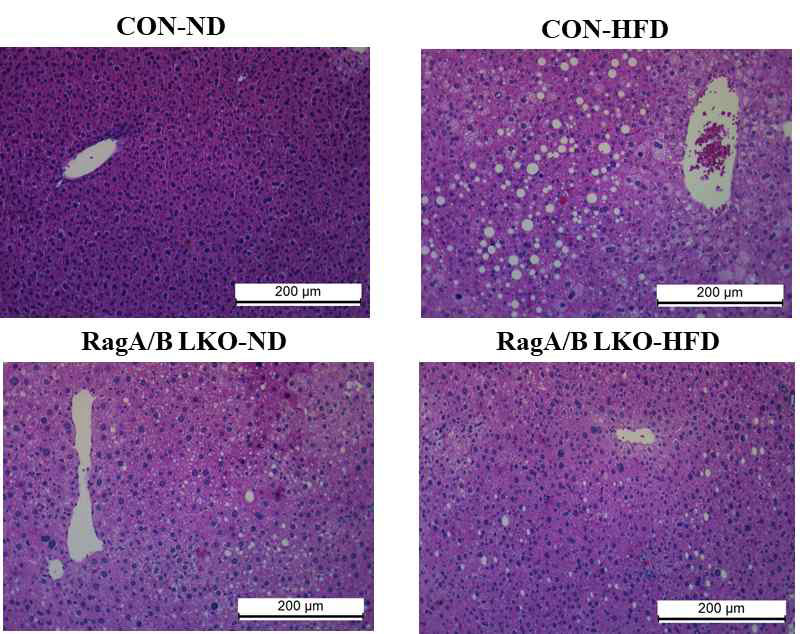 Pathological Analysis of Liver Tissue. Scale bars, 100 μm and 25 μm. CON, control mouse; RagA/B LKO, RagA/B liver conditional knockout mouse. ND, normal diet (AIN-93G); HFD, high-fat diet (60% fat)