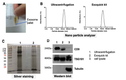 소변에서 분리된 exosome의 특성 및 그 분석 방법 (A) 소변에서 분리된 exosome (B) exosome의 사이즈 분석 (nano particle analyzer) (C) exosome에서 분리된 총 단백질 의 분석 (Sliver staining) (D) exosome 마커의 유무로 exosome의 분리 순도 확인 (Western blot)