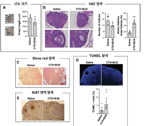 조기 난소 부전 마우스 모델의 확립 (A)난소 크기 (B) H&E 염색으로 follicle의 수 비교, Aretic follicle의 분석 (C) Sirus red 염색을 통한 섬유화 정도 비교 (D) TUNEL 분석을 통한 apoptotic cell 분석 (E)Ki67면역 염색 분석으로 생장하는 세포분석