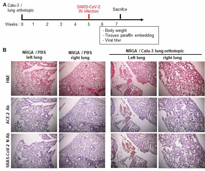 마우스에 Calu-3 세포주를 i.b. 접종하여 폐에 암을 성장시킨 후에 SARS-CoV-2를 흡입 감염시켰을 때 마우스의 폐 조직에 암이 성장하고, ACE2 및 SARS-CoV-2 N 단백질의 발현을 확인한 실험.