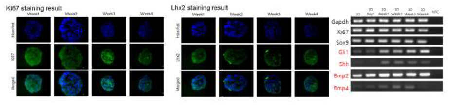 모낭줄기세포 3차원 세포구상체의 염색결과 및 성장기 단계 마커 발현