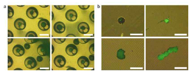 Lipid 염색된 adipocyte 스페로이드 사진