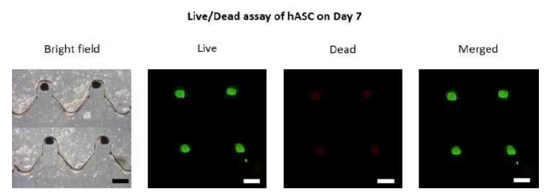 hASC 스페로이드의 live/dead 실험 결과 사진