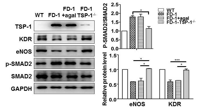 파브리병 환자 세포 내 TSP1 유전자 결손으로 인한 혈관병증 완화. 혈관형성인자 (KDR, eNOS) 발현이 TSP1 유전자 결손시 증가하였고, SMAD2 신호전달체계 활성히 감소하였음.