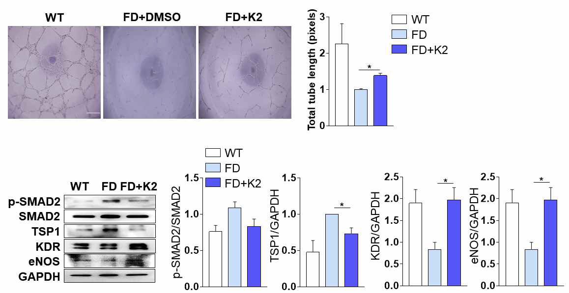 K2 (1uM)을 파브리병 역분화줄기세포 유래 혈관내피세포에 처리하였을 시 TSP1 발현과 SMAD2 신호체계 활성도 및, 혈관형성인자 (KDR, eNOS) 발현 변화 분석