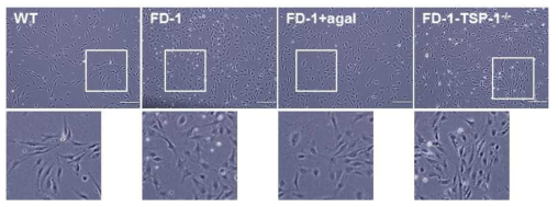 TSP1 유전자 결손된 FD1 역분화줄기세포에서 분화된 혈관내피세포의 형태학적 분석