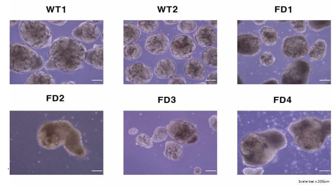 파브리병 유래 역분화 줄기세포로부터 분화된 신장 오가노이드