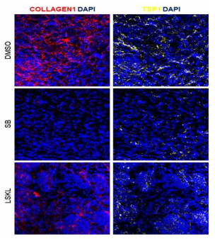 SMAD2 신호체계 억제 및 TSP1 발현억제를 통해 신장 섬유화증 마커 Collagen 1 발현 감소 분석