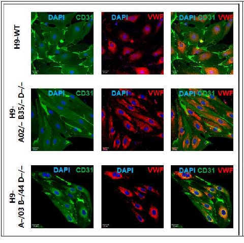 혈관내피세포로 분화 후 혈관내피세포 마커인 CD31과 VWF가 모든 세포에 잘 발현하고 있음을 확인