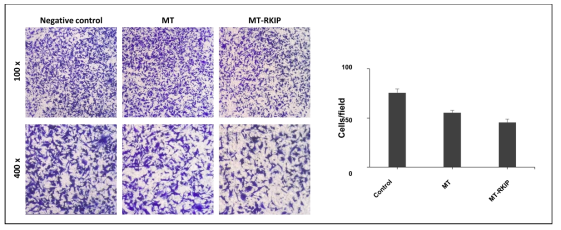 미토콘드리아-RKIP 결합체의 암세포 MDA-MB-231로 전달한 후 metastasis 관찰