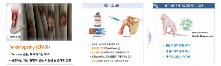 미토콘드리아를 이용한 건병증 치료제 개발 추진.