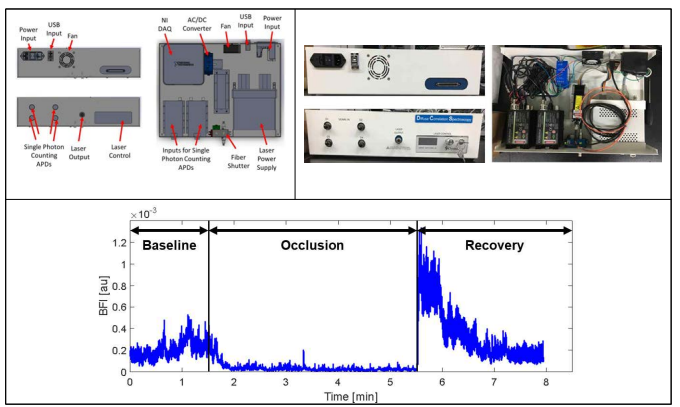 Diffuse Correlation Spectroscopy 시스템: 설계(상좌), 제작(상우), 시스템 성능검증 결과(하단)