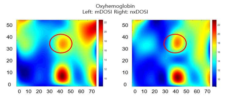 오른쪽 유방의 산소헤모글로빈 이미지 비교