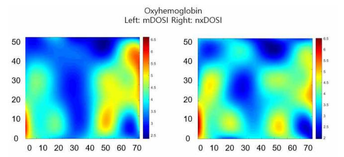 왼쪽 유방의 산소헤모글로빈 이미지 비교