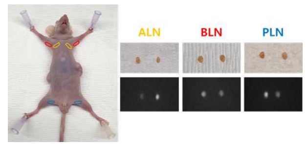 ICG를 이용한 위치별 림프절 형광 확인 (ALN : Axillary lymph node, BLN : Brachial lymph node, PLN : Popliteal lymph node)