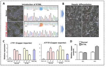 윌슨병 전분화능 줄기세포 제작 및 분화된 간세포의 질환 표현형적 특성 분석