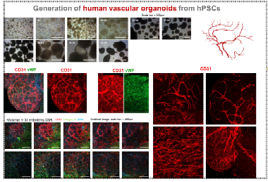 인간 전능성 줄기세포유래 분화 혈관세포를 이용한 혈 관오가노이드 형성