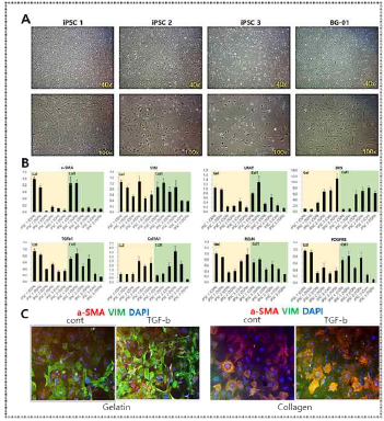 CD31 negative population cell의 hepatic lineage 분화 정도 분석 및 TGFb 처리를 통한 activation 검증.