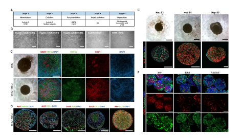 복합세포 조립을 통한 신규 간오가노이드 형성 기법 확립 (Scale bar = 200μm)
