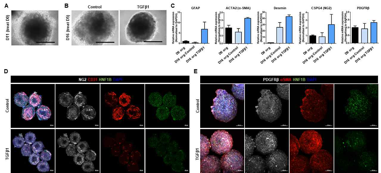 TGFβ1 장기간 처리를 통한 복합세포 간오가노이드의 간섬유화 모델링 및 분석. Scale bar = 200μm (A, B), 100μm (D, E)