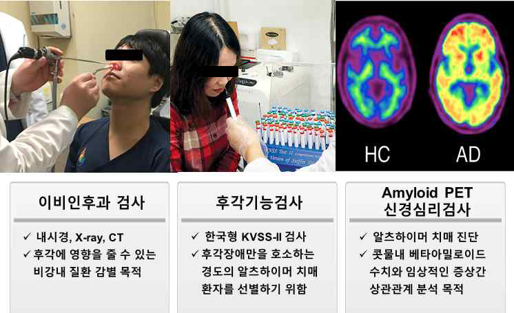 감별진단을 위한 이비인후과 검사, 후각기능검사 및 신경심리검사/Amyloid PET 등의 임상검사