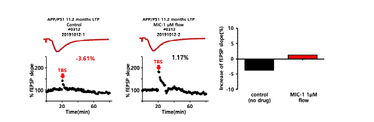 synaptic plasticity 조절 결과