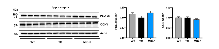 Western blot assay를 이용하여 hippocampus region의 바이오마커 level 분석