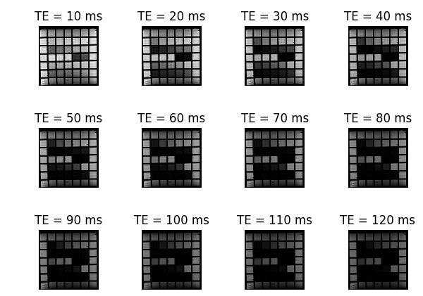 T2 images of contrast agents