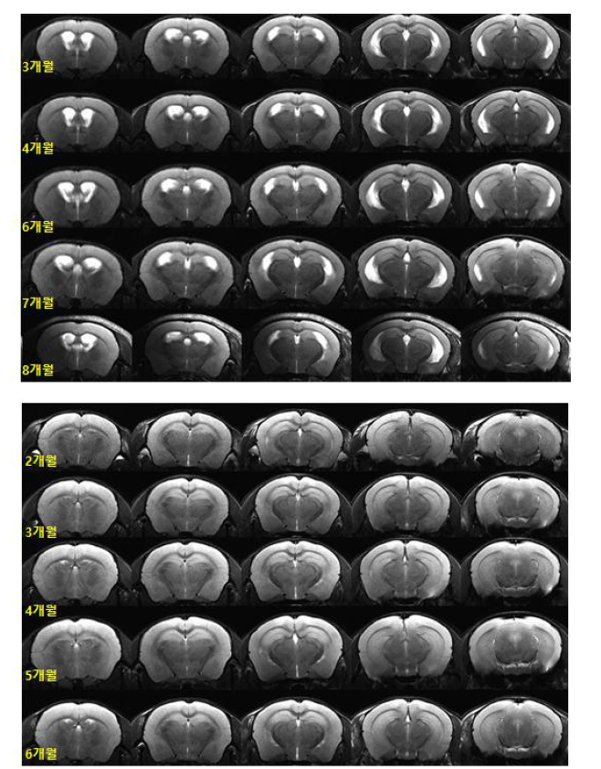 5XFAD 마우스의 성장 단계별 뇌 MRI 영상