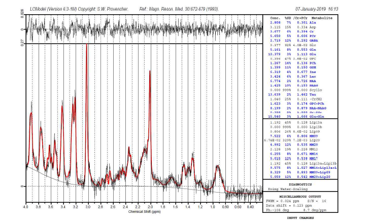 7개월령 5XFAD 마우스 해마의 대사물질변화를 측정한 해마의 스펙트럼