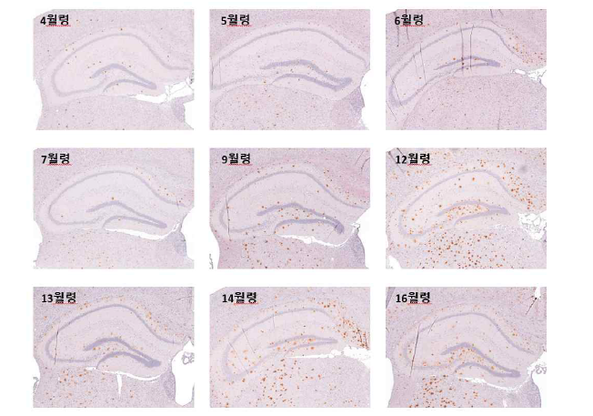 5XFAD 마우스의 월령별 dorsal hippocampus 영역의 베타 아밀로이드 염색 (갈색점)