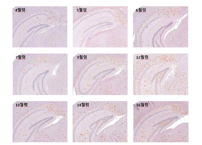 5XFAD 마우스의 월령별 ventral hippocampus 영역의 베타 아밀로이드 염색 샘플