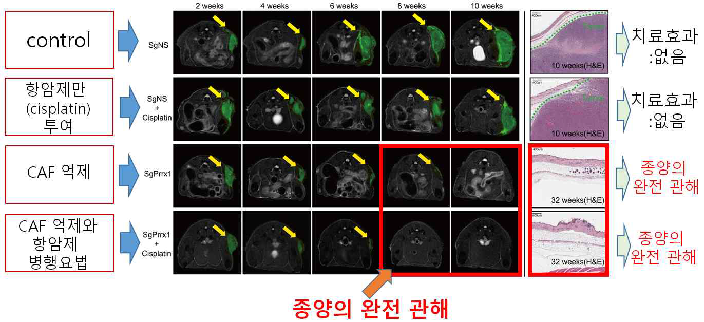 종양형성 후 Prrx1 억제유도 및 치료효과 확인한 MRI 사진
