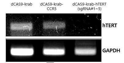 hTERT mRNA 발현