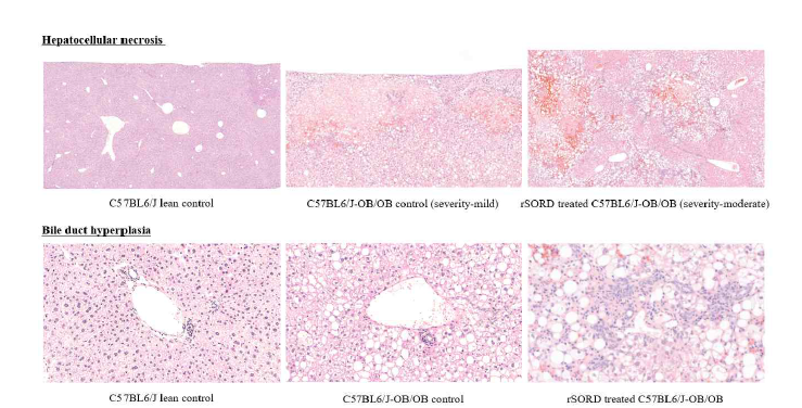 SORD 재조합 단백질 처리에 의한 간세포 괴사 및 담세관 이상 증식 비교 결과