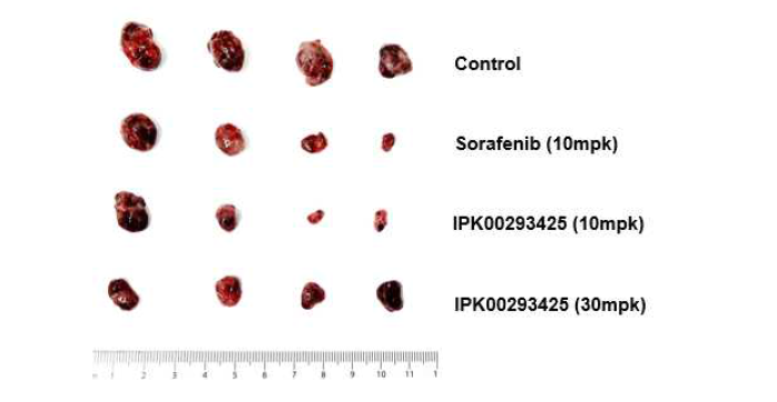 간암이소이식 모델에서 SORD억제제 약물 투여 시 종양 형성 확인
