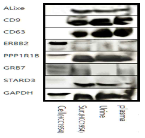 단백질 분석(western blot)을 이용한 타겟유전자 및 엑소좀 마커 확인