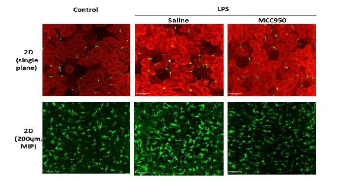 LPS 유발 급성신손상 신장에서 신장내 CD11c 세포의 변화