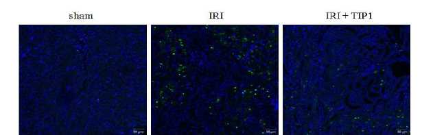 CD11c mice 허혈재관류 신손상 모델에서 TIP1이 CD11c 양성세포에 미치는 영향
