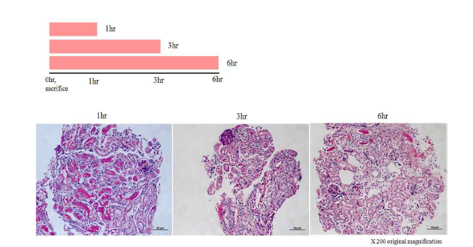 cold ischemia-reperfusion 모델에서 시간에 따른 세관 손상의 진행