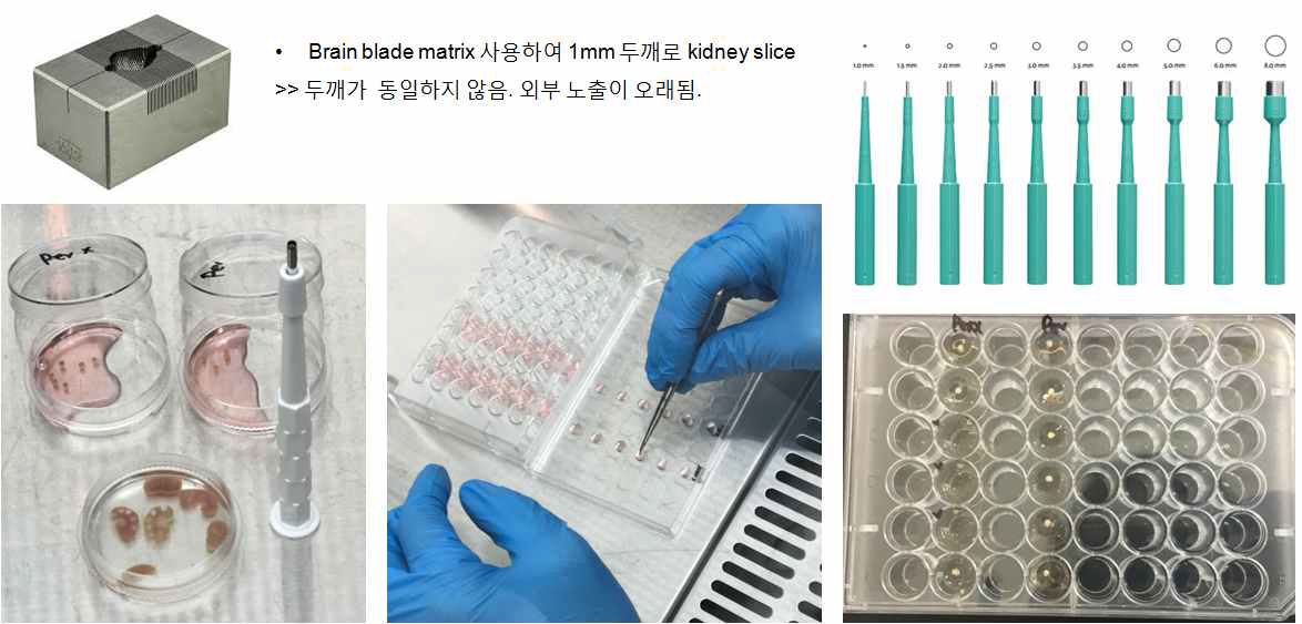 hangdrop 방법을 이용한 cold ischemia-reperfusion 모델 개발