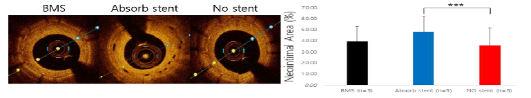 OCT를통한 neointimal area(%) 측정및OCT 대표이미지(BMS: bare-metal stent, NO: nitric oxide)