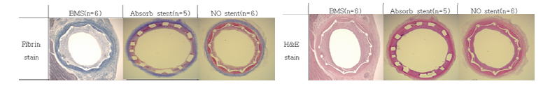 심장 혈관 조직의 Carstair's fibrin 및 H&E 염색