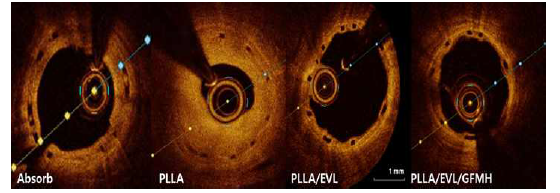 OCT를 이용한 심혈관 중재용 융해성 고분자 융합지지체 이식 4주 후 사진 (GFMH: grafting form magnesium hydroxide)