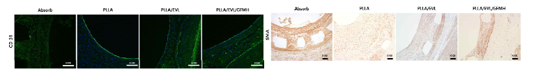 각 그룹의 면역 염색 대표 조직 사진. 재내피화를 평가하기 위하여 형광 면역 염색으로 CD31 발현을 확인하였으며, 평활근세포의 증식을 평가하기 위하여 면역염색 DAB으로 α-SMA의 발현을 확인함