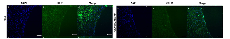 형광 염색을 통한 내피세포 증식 평가. (A, D) DAPI, (B, E) CD31 및 (C, F) Merge