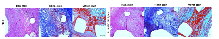 조직 염색을 통한 염증과 혈전 평가. (A, D) H&E stain, (B, E) fibrin stain 및 (C, F) Movat's stain