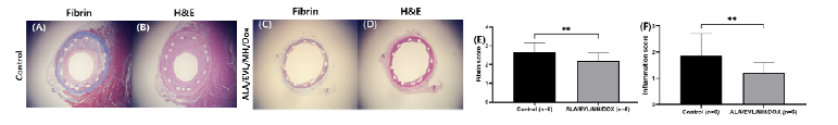 심혈관 중재용 융해성 고분자 융합 지지체 스트러트 주변 조직 염색 사진. (A, C) Fibrin stain, (B, D) H&E stain, (E) fibrin score 및 (F) inflammation score